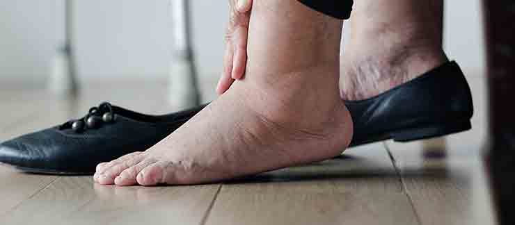 Foot Problems in the Elderly and Fall Risk