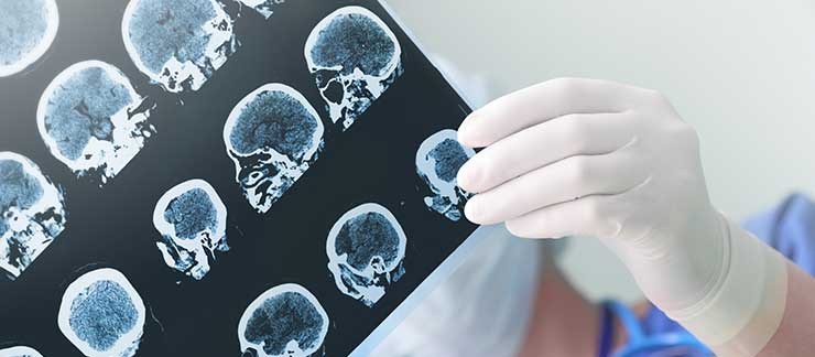 Closeup of a surgeon holding a head x-ray.