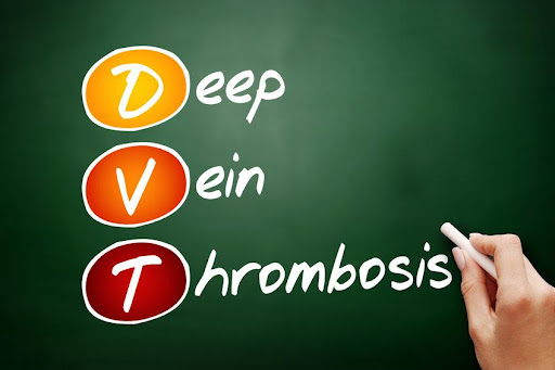 Understanding Deep-Vein Thrombosis