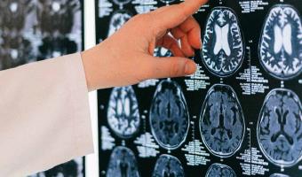 Brain Injury Awareness Month: Brain Injuries in Seniors