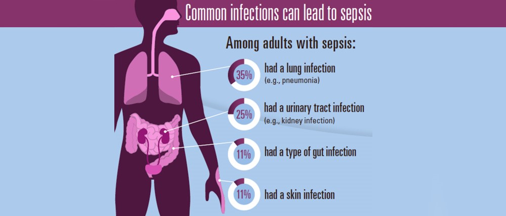 Infections leading to sepsis