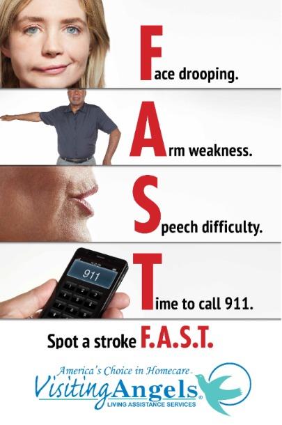 Know the FAST signs of stroke